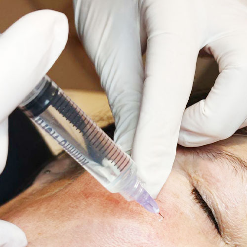 Bettina Marx - MESOTHERAPIE