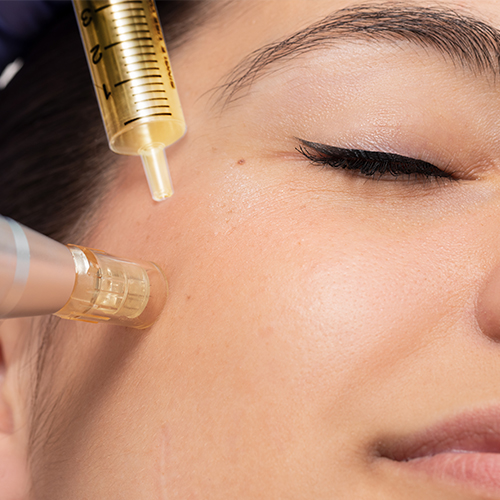 Bettina Marx - Microneedling